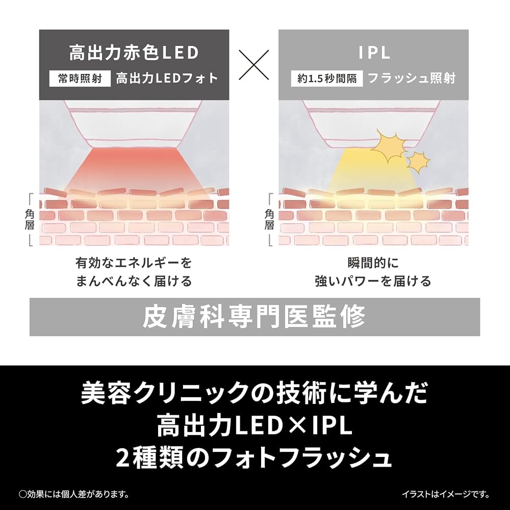 パナソニック フォト ブライトショット EH-SL85-W LED×IPL 光美顔器 画像4